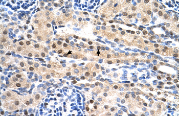 SULF2 Rabbit Polyclonal Antibody