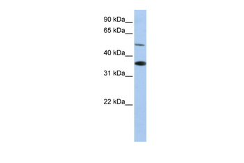 RHBG Rabbit Polyclonal Antibody