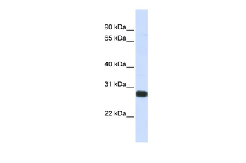 SPINT2 Rabbit Polyclonal Antibody