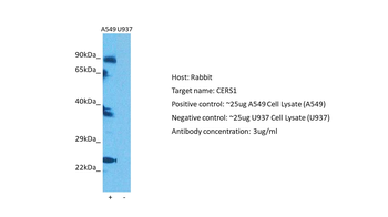 LASS1 Rabbit Polyclonal Antibody