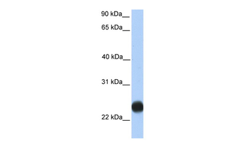 TMEM123 Rabbit Polyclonal Antibody