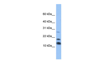 C1D Rabbit Polyclonal Antibody