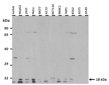 UXT Rabbit Polyclonal Antibody