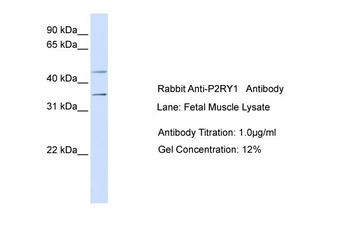 P2RY1 Rabbit Polyclonal Antibody