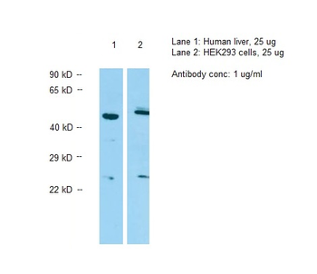 P2RY1 Rabbit Polyclonal Antibody