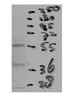 CETP Rabbit Polyclonal Antibody