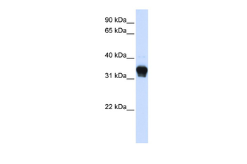CSNK1A1 Rabbit Polyclonal Antibody