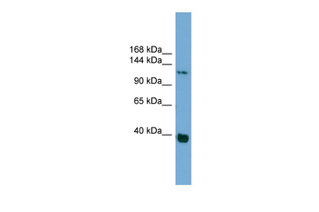 CTNND1 Rabbit Polyclonal Antibody