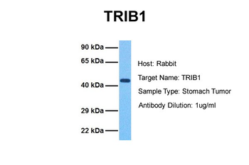 TRIB1 Rabbit Polyclonal Antibody