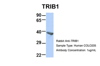 TRIB1 Rabbit Polyclonal Antibody