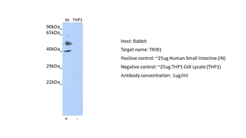 TRIB1 Rabbit Polyclonal Antibody