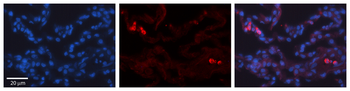 TRIB1 Rabbit Polyclonal Antibody