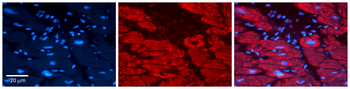 TRIB1 Rabbit Polyclonal Antibody