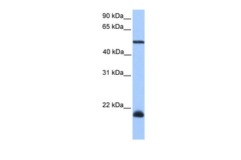 DNAAF4 Rabbit Polyclonal Antibody