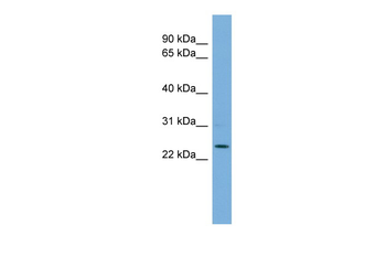 THAP6 Rabbit Polyclonal Antibody