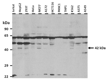 FBXO32 Rabbit Polyclonal Antibody