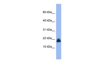 Cst6 Rabbit Polyclonal Antibody