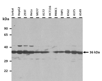 LDHC Rabbit Polyclonal Antibody