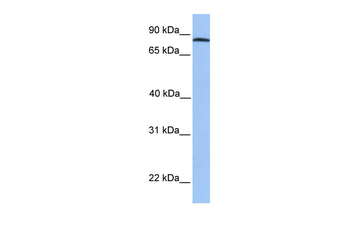 ADAM7 Rabbit Polyclonal Antibody
