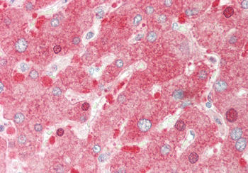 PDE1A Rabbit Polyclonal Antibody