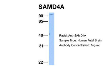 SAMD4A Rabbit Polyclonal Antibody