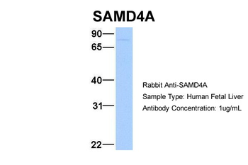 SAMD4A Rabbit Polyclonal Antibody