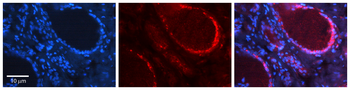 SQSTM1 Rabbit Polyclonal Antibody