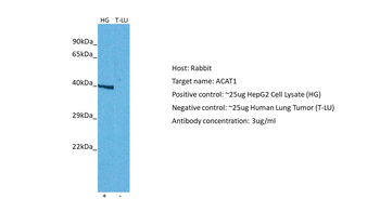 ACAT1 Rabbit Polyclonal Antibody