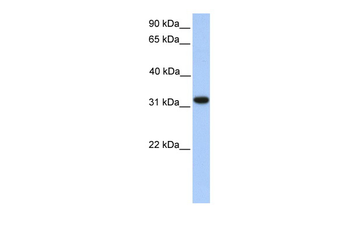 ETFA Rabbit Polyclonal Antibody