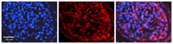 HK2 Rabbit Polyclonal Antibody
