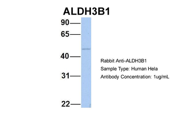 ALDH3B1 Rabbit Polyclonal Antibody