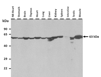 Usp21 Rabbit Polyclonal Antibody