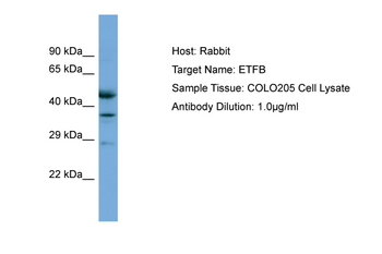 ETFB Rabbit Polyclonal Antibody