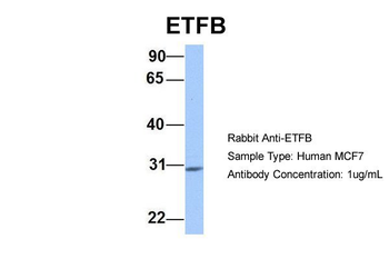 ETFB Rabbit Polyclonal Antibody