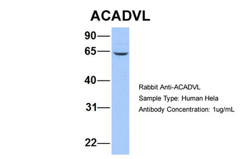 ACADVL Rabbit Polyclonal Antibody