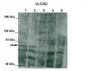 ACADVL Rabbit Polyclonal Antibody
