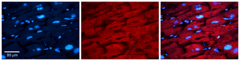 ARAF Rabbit Polyclonal Antibody