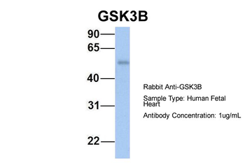 GSK3B Rabbit Polyclonal Antibody