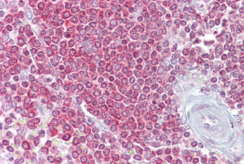 RPSA Rabbit Polyclonal Antibody