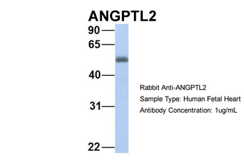 ANGPTL2 Rabbit Polyclonal Antibody