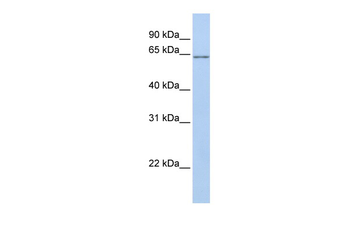ANGPTL2 Rabbit Polyclonal Antibody