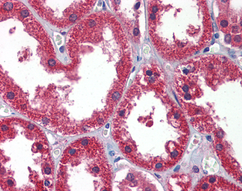 DDAH1 Rabbit Polyclonal Antibody