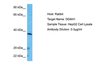 DDAH1 Rabbit Polyclonal Antibody