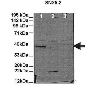 SNX5 Rabbit Polyclonal Antibody