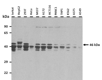 NAPE-PLD Rabbit Polyclonal Antibody