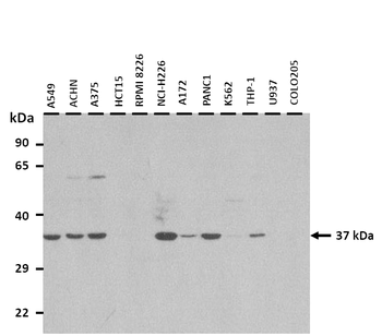 MTHFD2L Rabbit Polyclonal Antibody