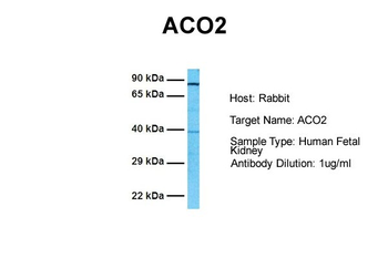 ACO2 Rabbit Polyclonal Antibody