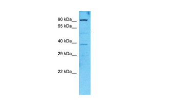 ACO2 Rabbit Polyclonal Antibody