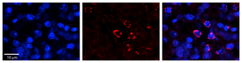 FANCL Rabbit Polyclonal Antibody