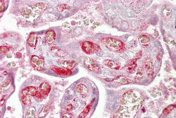 PPP2R3A Rabbit Polyclonal Antibody